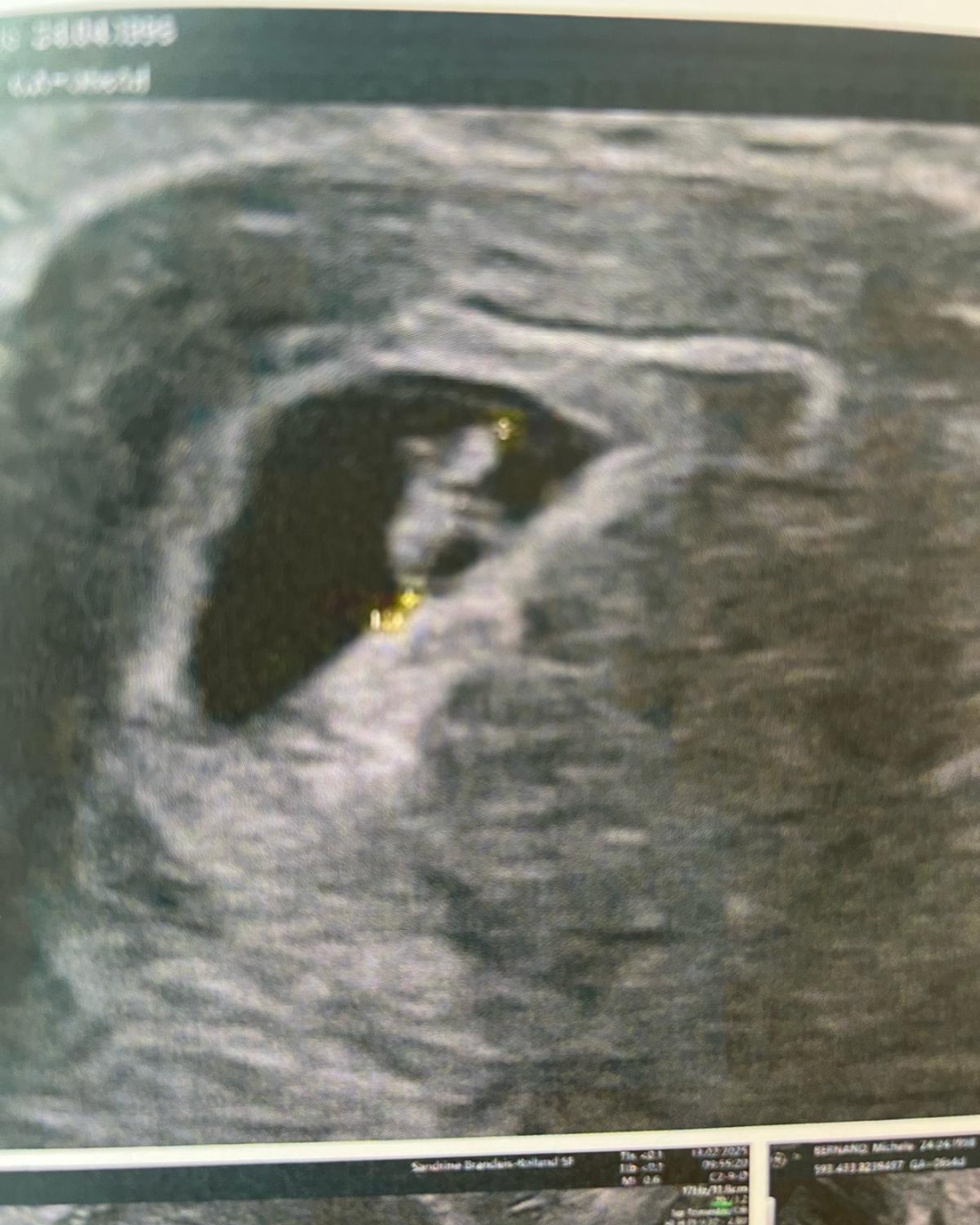 Photo après traitement